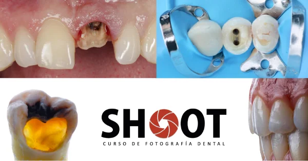 SHOOT_ Fotografía dental